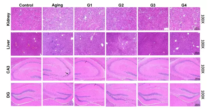 Erregende Ergebnisse im Modell des natürlichen Alterns