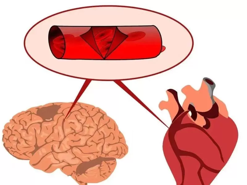 Anti-Aging-Serie: Resveratrol