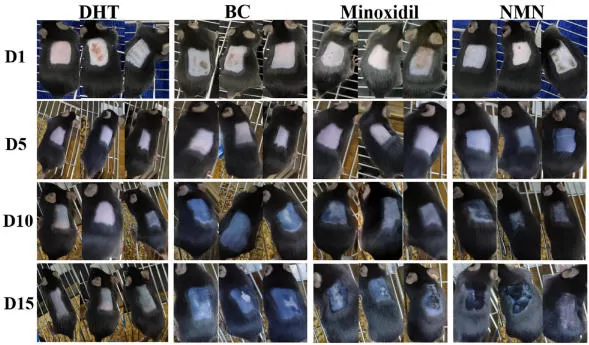 NMN und Haar wachstum: Neue Hinweise auf androgene tische Alopezie (AGA)